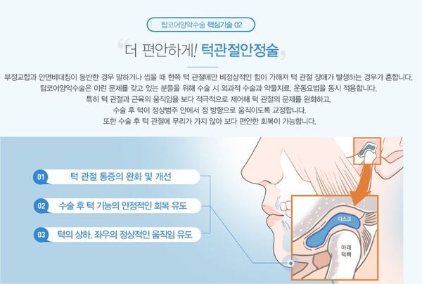 양악수술잘하는곳 강남역 신데렐라로! 3